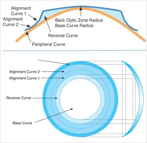 An Ortho-K Reverse Geometry Lens