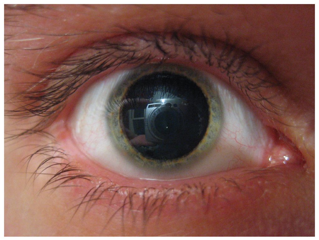 eye pupil dilation drugs